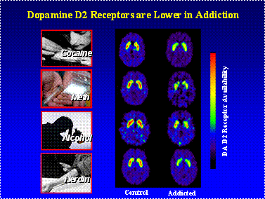 www.hbo.com-addiction-understanding_addiction-12_pleasure_pathway